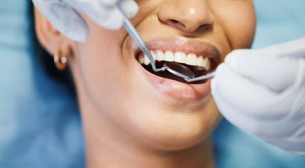 Best Emergency Dental Care for Abscessed Tooth in Pine Nyon, CA