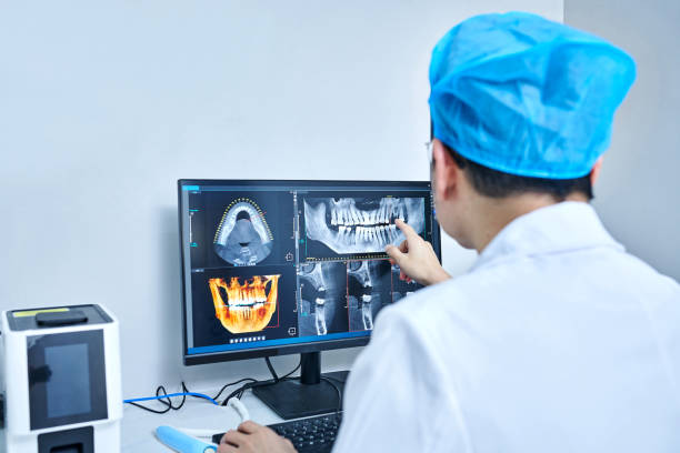 Best Emergency Dental Extractions in Pine Nyon, CA